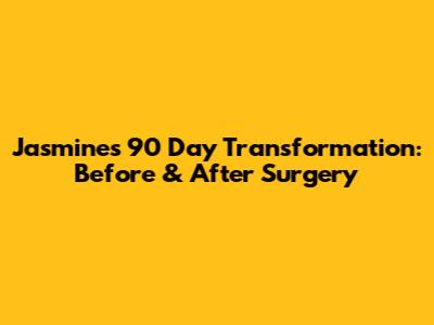 Jasmine's 90 Day Transformation: Before & After Surgery
