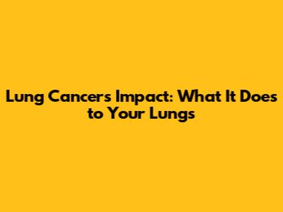 Lung Cancer's Impact: What It Does to Your Lungs