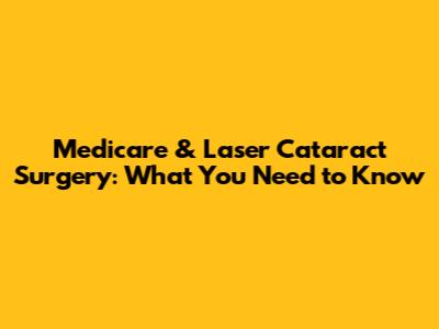 Medicare & Laser Cataract Surgery: What You Need to Know